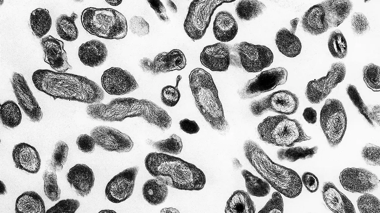 Transmission electron microscopic (TEM) image, revealed ultrastructural details exhibited by numerous, Coxiella burnetii bacteria, which cause the worldwide dis